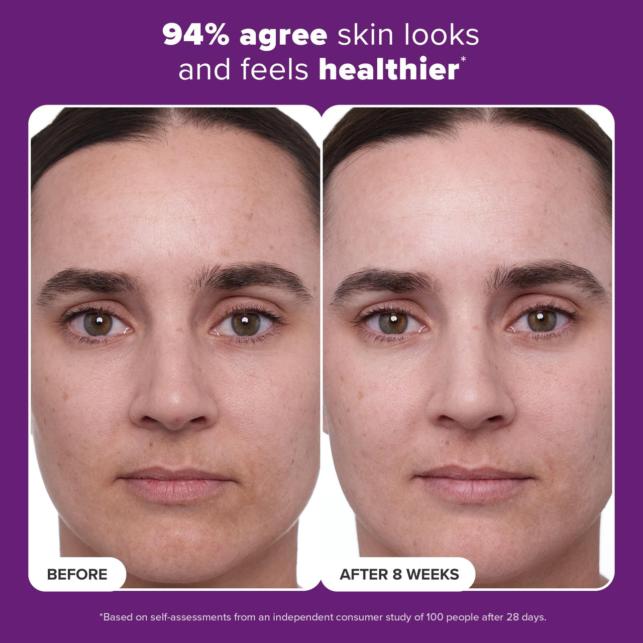 Paula's Choice CLINICAL 1% Retinol Face Treatment with Peptides, Vitamin C & Licorice Extract, Anti-Aging Skin Care Serum, Fine Lines & Wrinkles, Fragrance Free, 1 Fl Oz