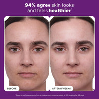 Thumbnail for Paula's Choice CLINICAL 1% Retinol Face Treatment with Peptides, Vitamin C & Licorice Extract, Anti-Aging Skin Care Serum, Fine Lines & Wrinkles, Fragrance Free, 1 Fl Oz