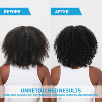 Thumbnail for CeraVe 2 In 1 Hydrating Anti Dandruff Shampoo And Conditioner Twin Pack, 1% Pyrithione Zinc Dandruff Treatment Helps Eliminate Dandruff, Color Safe & Sulfate Free, 12 Fl Oz Each (Set of 2)