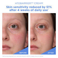 Thumbnail for AESTURA ATOBARRIER365 Cream with Ceramides, Korean Face Moisturizer for Barrier Repair | 120H lasting Hydration, Ceramide Capsules, Dry & Sensitive Skin, Non-comedogenic, 80 mL / 2.70 fl.oz.