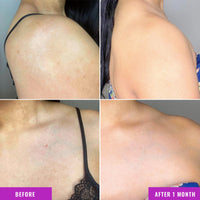 Thumbnail for Good Molecules Discoloration Correcting Body Treatment - Cream with Tranexamic Acid Ester Salt, LHA, and Niacinamide - Anti-aging Skincare for Body