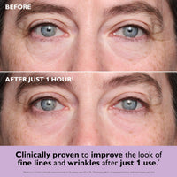 Thumbnail for Peter Thomas Roth | Instant FIRMx® Collagen Tightening Eye Patches | Eye Patches For Firming Under-Eye Bags & Wrinkles | Eye Masks For Puffiness