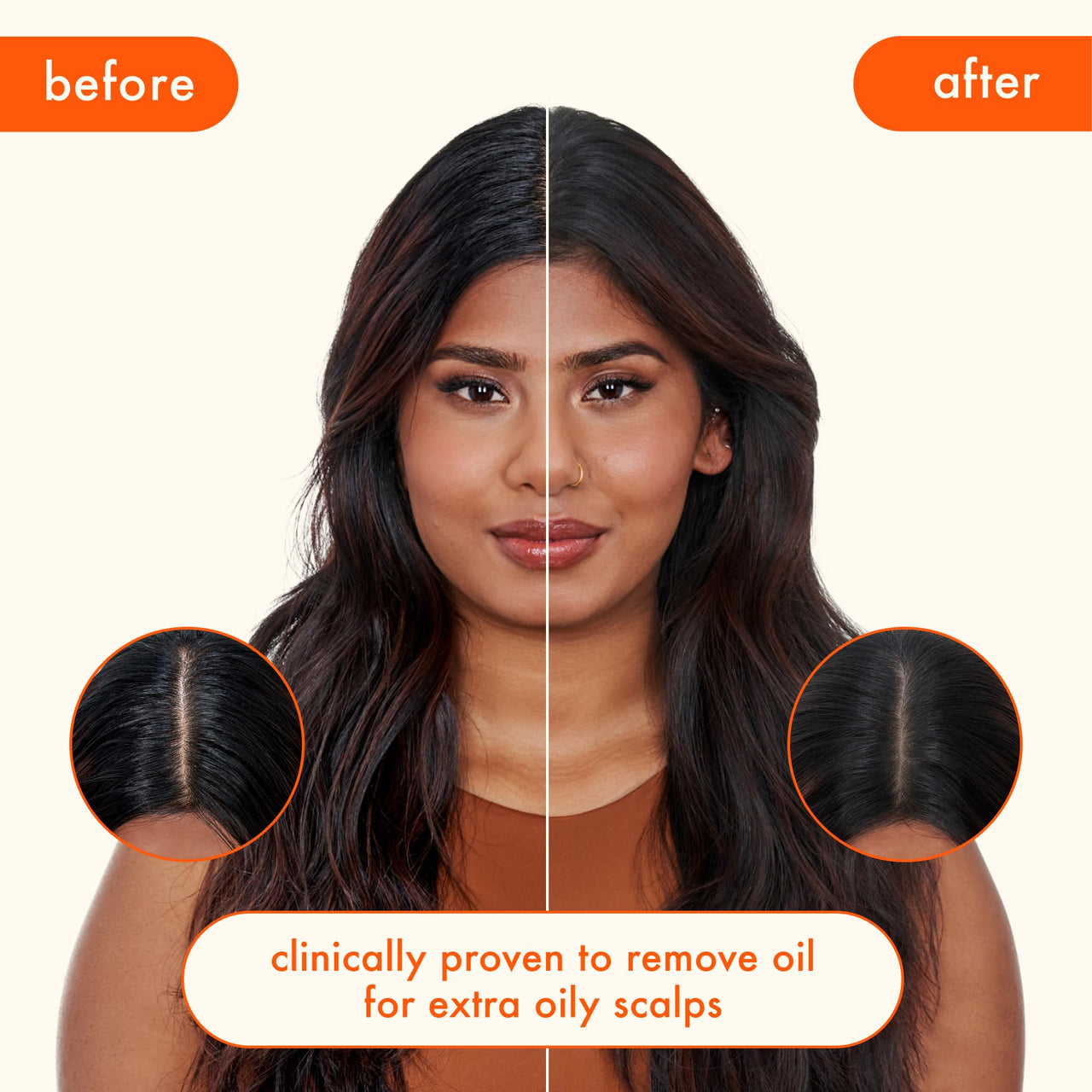 amika Perk Up Ultra Oil Control Dry Shampoo, 5.3oz | absorbs + helps control oils | refreshes scalp + roots | extends styles between washes | for extra oily scalps that need oil control