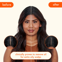 Thumbnail for amika Perk Up Ultra Oil Control Dry Shampoo, 5.3oz | absorbs + helps control oils | refreshes scalp + roots | extends styles between washes | for extra oily scalps that need oil control