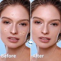 Thumbnail for Daolyo Pimple Patches for Face, 4 Size 300 Counts Acne Patches, Hydrocolloid Patches for Covering Zits and Blemishes, Spot Stickers with Salicylic Acid, Tea Tree Oil & Calendula Oil