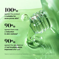 Thumbnail for Anua Azelaic Acid 10 Hyaluron Redness Soothing Serum, Facial Serum for Blemish-Prone & Sensitive Skin, Lightweight & Hydrating Blemish Care, Hyaluronic Acid, Korean Skincare, 1.01 fl oz.