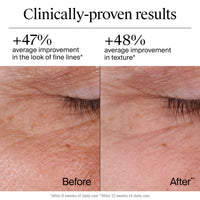 Thumbnail for Neutrogena Rapid Wrinkle Repair Retinol Face Moisturizer, Daily Anti-Aging Face Cream with Retinol & Hyaluronic Acid to Fight Fine Lines, Wrinkles, & Dark Spots, 1.7 oz