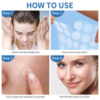 Thumbnail for Daolyo Pimple Patches for Face, 4 Size 300 Counts Acne Patches, Hydrocolloid Patches for Covering Zits and Blemishes, Spot Stickers with Salicylic Acid, Tea Tree Oil & Calendula Oil