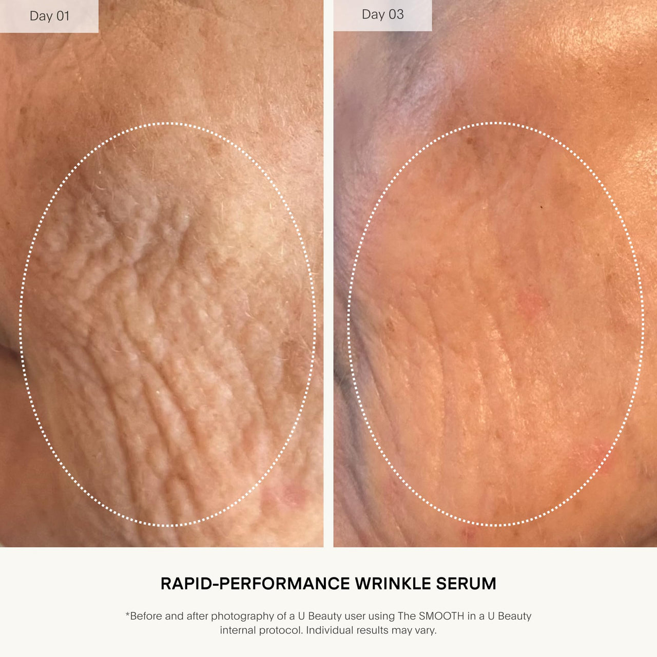 U Beauty The SMOOTH Dynamic Wrinkle Defense Serum - Multi-Peptide Complex, Copper Peptides, Retinol, Centella Exosomes, Vegan Silk Protein for Visible Wrinkle Reduction, Firming & Hydration 5ml