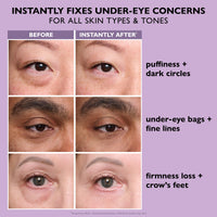 Thumbnail for Peter Thomas Roth | Instant FIRMx® Eye Temporary Eye Tightener Easy-Wear Formula