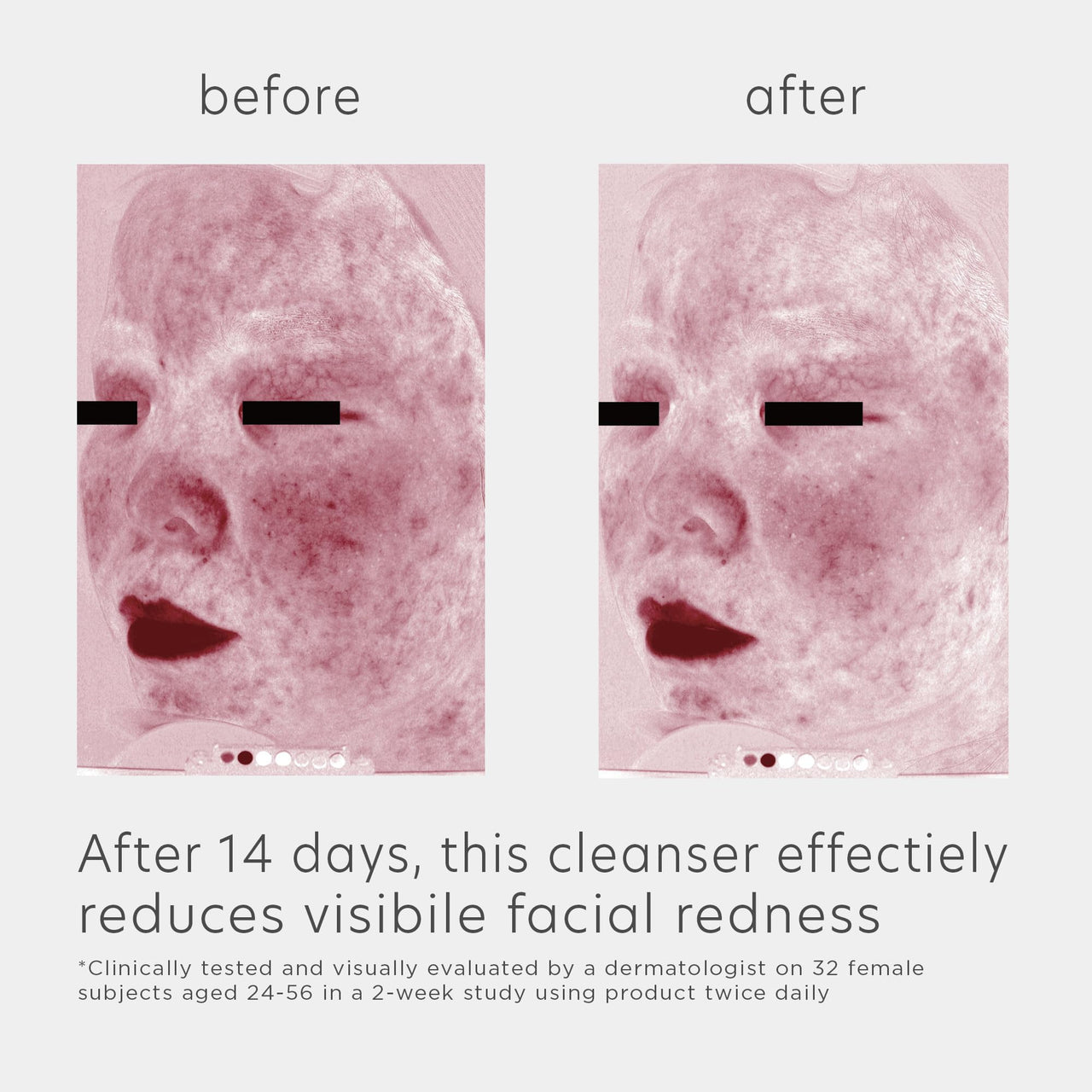 EltaMD Skin Recovery Amino Acid Foaming Facial Cleanser, Gentle Face Cleanser for Sensitive Skin, 5.0 Fl Oz