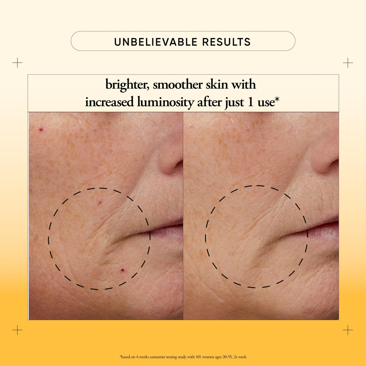 philosophy microdelivery vitamin c resurfacing peel kit - with lactic acid & sunflower seed oil - two-step treatment to smooth rough texture, even skin tone and minimize the appearance of fine lines