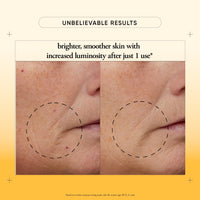 Thumbnail for philosophy microdelivery vitamin c resurfacing peel kit - with lactic acid & sunflower seed oil - two-step treatment to smooth rough texture, even skin tone and minimize the appearance of fine lines