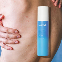 Thumbnail for Murad Clarifying Body Spray - Daily Salicylic Acid Treatment to Clear and Prevent Body Acne and Breakouts, 6Fl Oz
