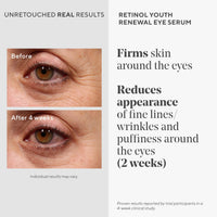 Thumbnail for Murad Retinol Youth Renewal Eye Serum - Retinol Eye Serum Visibly Improves Undereye Puffiness Dark Circles and Reduces the Appearance of Fine Lines, Gentle Enough for Nightly Use - 0.5 oz