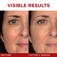 Thumbnail for L'Oreal Paris Revitalift Triple Power Anti-Aging Face Moisturizer, Pro Retinol, Hyaluronic Acid & Vitamin C to Reduce Wrinkles, Firm & Brighten Skin, 1.7 Oz