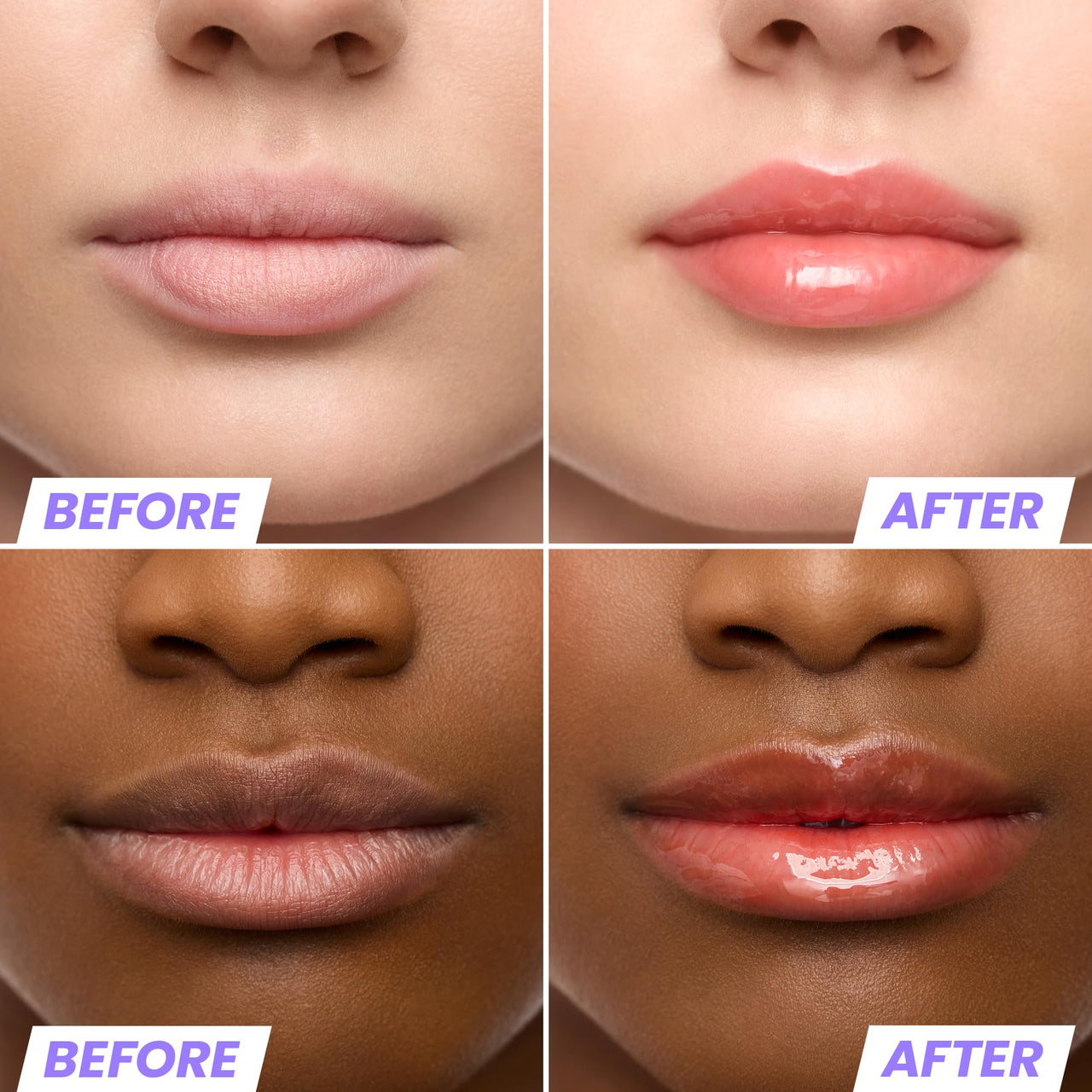 Wonderskin Lip Rehab Serum Oil - Tinted Lip Oil for Women, Hydrating, Moisturizing, and Non-Sticky Bright Red Tint Serum for Dry Lips (Flirt)