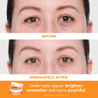 Thumbnail for Peter Thomas Roth | Full-Size Vitamin C & Hyaluronic Eye Patches 2-Piece Kit