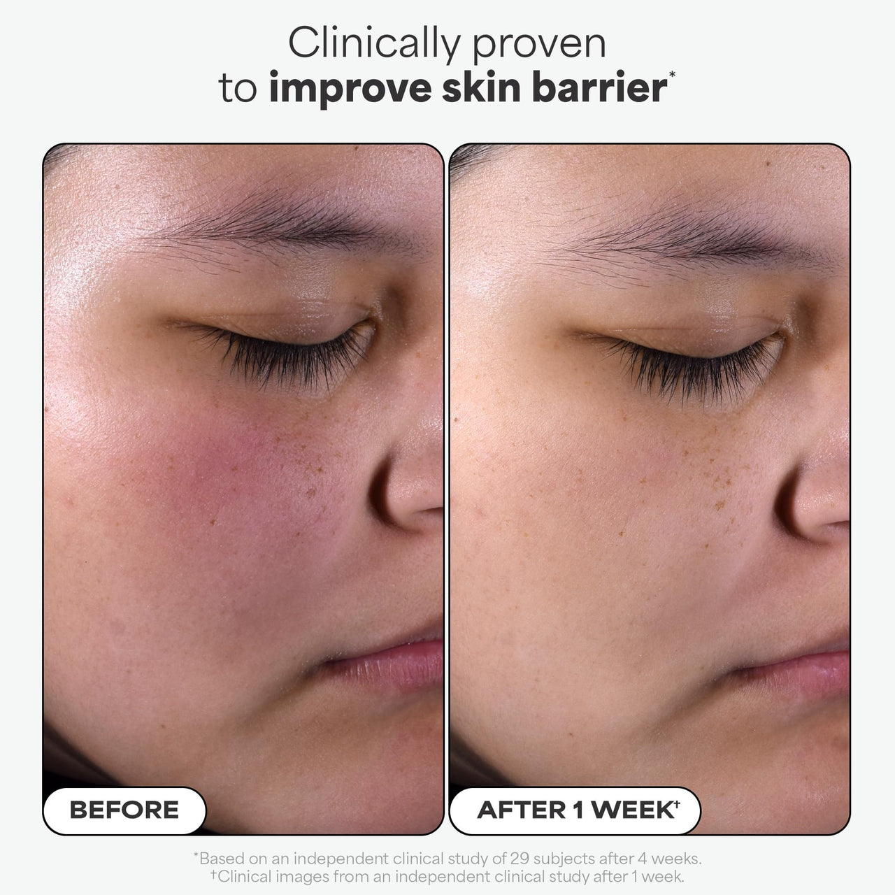 Paula's Choice SKIN PERFECTING 2% BHA Liquid Salicylic Acid Exfoliant-Facial Exfoliant for Enlarged Pores, Wrinkles & Fine Lines, Suitable for Blackhead-Prone Skin, Fragrance-Free
