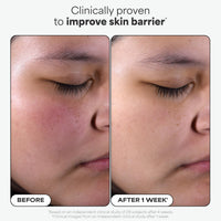 Thumbnail for Paula's Choice SKIN PERFECTING 2% BHA Liquid Salicylic Acid Exfoliant-Facial Exfoliant for Enlarged Pores, Wrinkles & Fine Lines, Suitable for Blackhead-Prone Skin, Fragrance-Free
