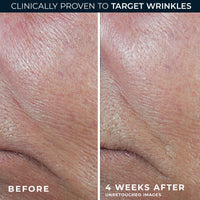 Thumbnail for RoC Derm Correxion Retinol Firming Serum Stick with Antioxidants to Visibly Tighten and Firm Wrinkles and Laugh Lines 1.0 oz plus Retinol Eye Cream Packette
