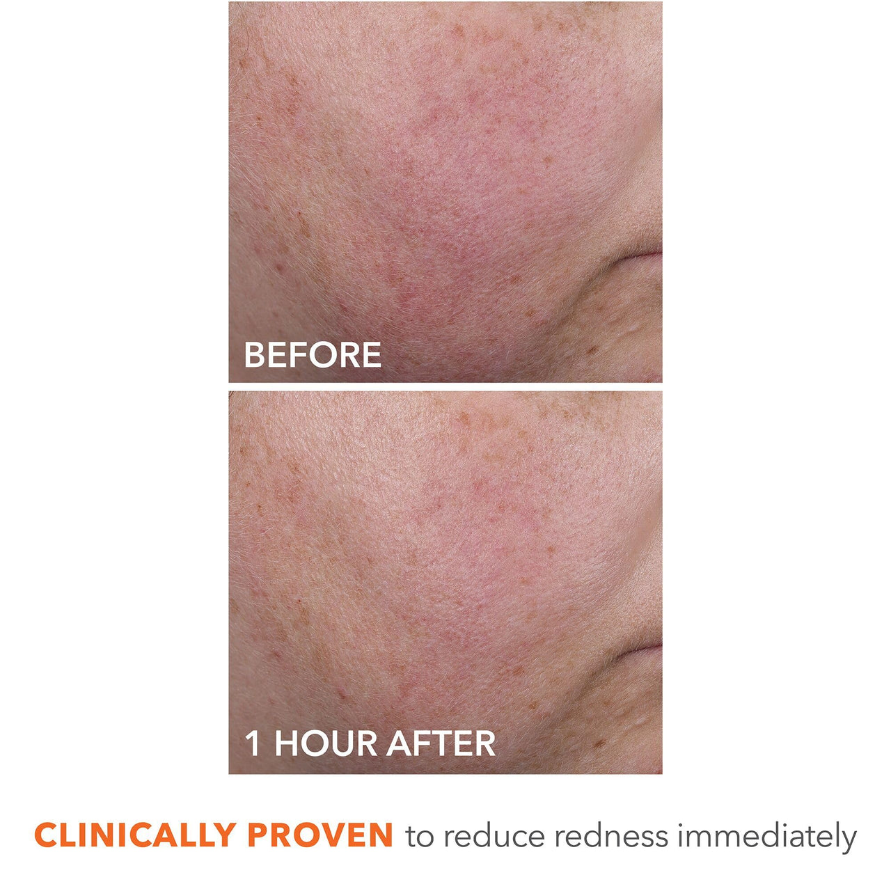 Dr Dennis Gross DermInfusions Blur + Repair Cream, Instantly Blurs Fine Lines, Smooths Skin with Satin-Matte Finish, Visibly Plumps & Firms, Reduces Redness, and Improves Skin Elasticity, 1.7 Fl Oz