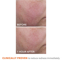 Thumbnail for Dr Dennis Gross DermInfusions Blur + Repair Cream, Instantly Blurs Fine Lines, Smooths Skin with Satin-Matte Finish, Visibly Plumps & Firms, Reduces Redness, and Improves Skin Elasticity, 1.7 Fl Oz