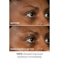 Thumbnail for Dr Dennis Gross DermInfusions Lift + Repair Eye Mask | Visibily Lift + Firm, Fills the Appearance of Fine Lines, Hydrates + Repairs Skin Barrier, Visibly Depuffs Undereye Area | 1 Treatment 0.33 fl oz