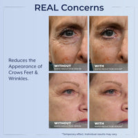 Thumbnail for Plexaderm Rapid Reduction Eye Serum - Visibly Reduces Under-Eye Bags, Wrinkles, Dark Circles, Fine Lines & Crow's Feet Instantly, Anti Aging Wrinkle Remover for Face, Full Size Tube
