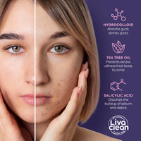 Thumbnail for LivaClean Star Pimple Patches for Face w/Hydrocolloid, Salicylic Acid & Tea Tree, 240 Patches, Hydrocolloid Acne Patch, Cute Star Pimple Patch for Healing Stickers Zit Superstar