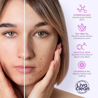 Thumbnail for LivaClean 330 CT Pimple Patches for Face w/Salicylic Acid, Tea Tree Oil & Calendula Oil - Four Sizes - Pimple Patch, Hydrocolloid Patch, Acne Patches for Face