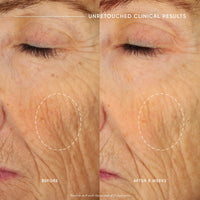 Thumbnail for philosophy ultimate miracle worker nourish & rejuvenate face & neck cream 2 fl oz