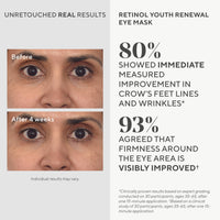 Thumbnail for Murad Dr. Zion Retinol Youth Renewal Eye Masks – No-Slip Under Eye Patches for Fine Lines, Wrinkles, Crow’s Feet and Puffy Eyes - Full Absorption Treatment Strips, 5 Pairs