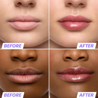 Thumbnail for Wonderskin Lip Oil Rehab Serum - Tinted Lip Oil, Hydrating, Moisturizing, and Non-Sticky Deep Red Tint Serum for Dry Lips (Honey)