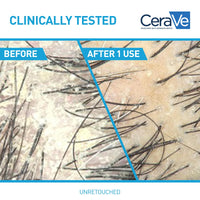 Thumbnail for CeraVe Hydrating Anti Dandruff Conditioner, 0.5% Pyrithione Zinc Dandruff Treatment With Ceramides, Hyaluronic Acid & Niacinamide, Helps Eliminate Flakes & Reduce Itchy Scalp, Sulfate Free Conditioner