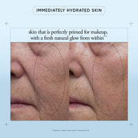 Thumbnail for philosophy hope in a jar glow water cream face moisturizer - with hyaluronic acid & pineapple extract provides 72-hour hydration & primes skin for makeup 2 fl oz