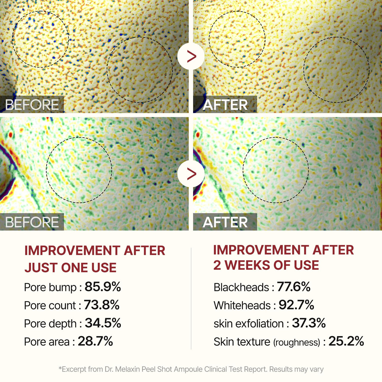 Dr.Melaxin Peel Shot Glow Black Rice Peeling Ampoule 80ml, Dead Skin Gentle Exfoliating Ampoule with Rice Water Extract, AHA BHA, Niacinamide, Daily Skin Texture Care, All Skin Types, Korean Skincare