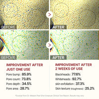 Thumbnail for Dr.Melaxin Peel Shot Glow Black Rice Peeling Ampoule 80ml, Dead Skin Gentle Exfoliating Ampoule with Rice Water Extract, AHA BHA, Niacinamide, Daily Skin Texture Care, All Skin Types, Korean Skincare