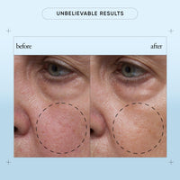 Thumbnail for philosophy hope in a jar biome-balance glow facial serum - with enhanced hyaluronic acid, prebiotic & AA2G - helps restore natural balance & provides instant, supercharged hydration - 1 fl oz