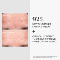 Thumbnail for Murad Retinol Youth Renewal Serum - Rapid-Action Retinol Treatment for Face and Neck - Visibly Reduces Lines and Wrinkles, Firms and Smooths Skin, Nightly Use Formula - 1.0 Fl Oz