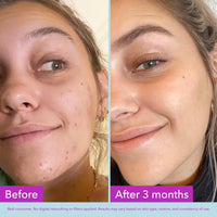 Thumbnail for Good Molecules Niacinamide Brightening Toner - Toner for Face with Niacinamide and Arbutin for Skin Tone Balancing- Pore Minimizer, Skin Care for Face