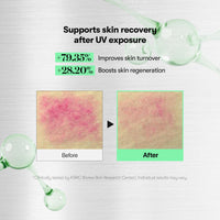 Thumbnail for VT COSMETICS CICA Reedle Shot 700, Spicule Microneedling Serum for Pore Care&Exfoliation, Exosome&Centella Asiatica for Glass Skin, Acne&Blemish Care, Korean Liquid Skin Booster (1 Fl Oz / 30ml)