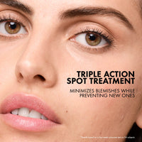 Thumbnail for Vichy Normaderm S.O.S Acne Rescue Spot Corrector, Acne Spot Treatment for Face with 10% Sulfur, Niacinamide & Glycolic Acid, Suitable for Sensitive Skin