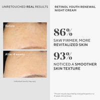 Thumbnail for Murad Retinol Youth Renewal Night Cream - Anti-Aging Moisturizer with Retinol Tri-Active Technology and Niacinamide Gently Fights Wrinkles and Fine Lines, Boosts Radiance and Firms Skin - 1.7 Fl Oz