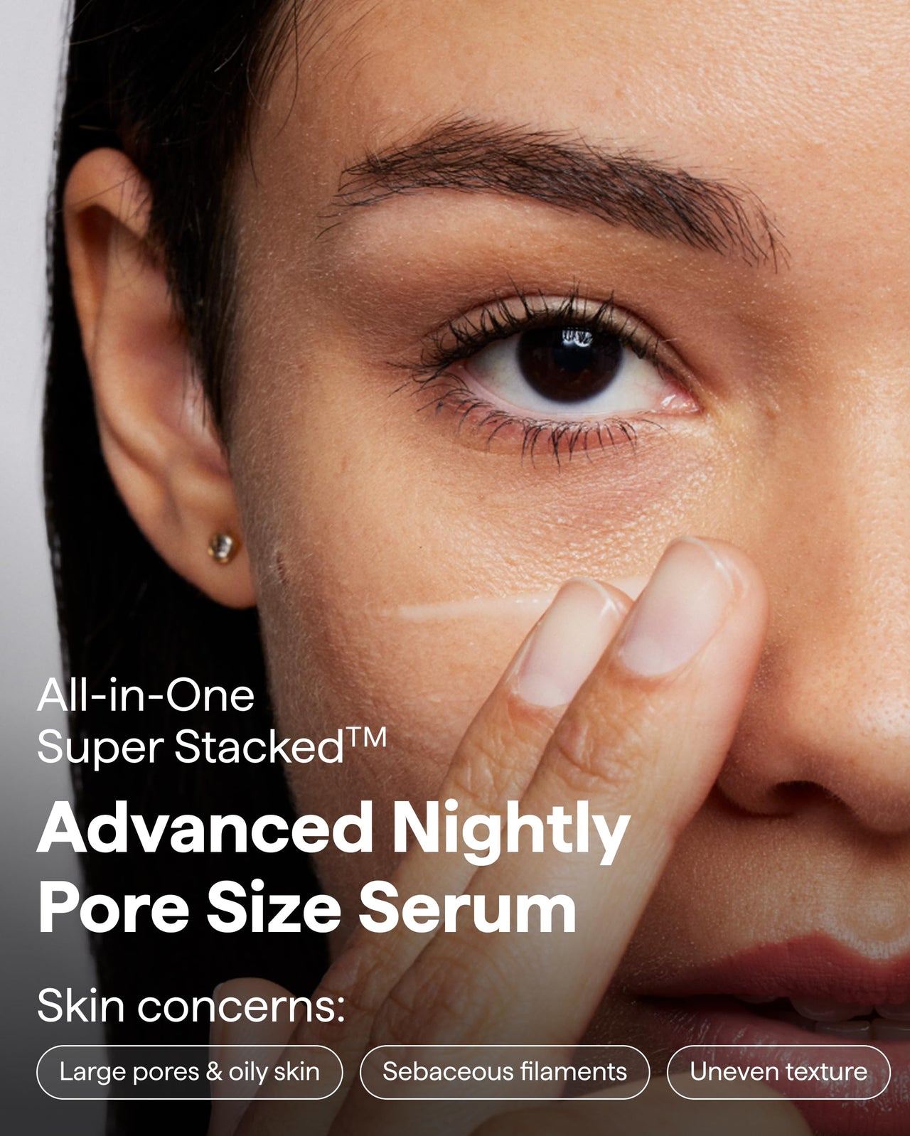 Remedy for Pore Size | Pore Refining Advanced Serum | Large Pore Minimizer with Retinol, BHA Salicylic Acid, Niacinamide | for Texture, Pimples, Blackheads | by Dermatologist Dr. Shah