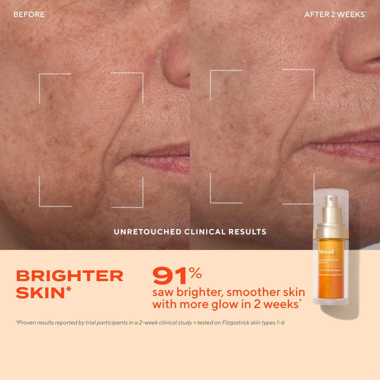 Murad Vita-C Glycolic Serum - Advanced Brightening Vitamin C and Glycolic Acid Face Serum for Improved Skin Tone and Texture - Gold-Stabilized Vitamin C for Enhanced Efficacy and Potency - 1 Fl Oz