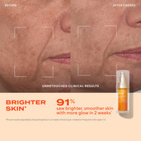 Thumbnail for Murad Vita-C Glycolic Serum - Advanced Brightening Vitamin C and Glycolic Acid Face Serum for Improved Skin Tone and Texture - Gold-Stabilized Vitamin C for Enhanced Efficacy and Potency - 1 Fl Oz