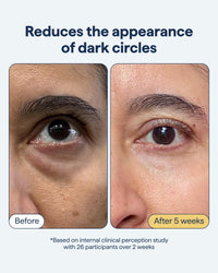 Thumbnail for Remedy Dark Circles Reducing Advanced Eye Cream | Undereye Discoloration Treatment | Caffeine, Kojic Acid, Niacinamide, Marine Algae Complex | By Dermatologist Dr. Shah, 0.5 fl. Oz