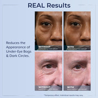 Thumbnail for Plexaderm Rapid Reduction Eye Serum - Visibly Reduces Under-Eye Bags, Wrinkles, Dark Circles, Fine Lines & Crow's Feet Instantly, Anti Aging Wrinkle Remover for Face, Full Size Tube