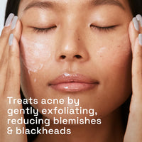 Thumbnail for Cetaphil Gentle Clear Pore Clearing Acne Cleanser, Foaming Gel Cleanser for Sensitive, Acne-Prone Skin, 8 Fl Oz Pump Bottle, 2% Salicylic Acid, Gently Exfoliates, Dermatologist Recommended Brand
